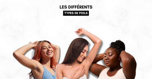 DIFFÉRENTS TYPES DE POILS...