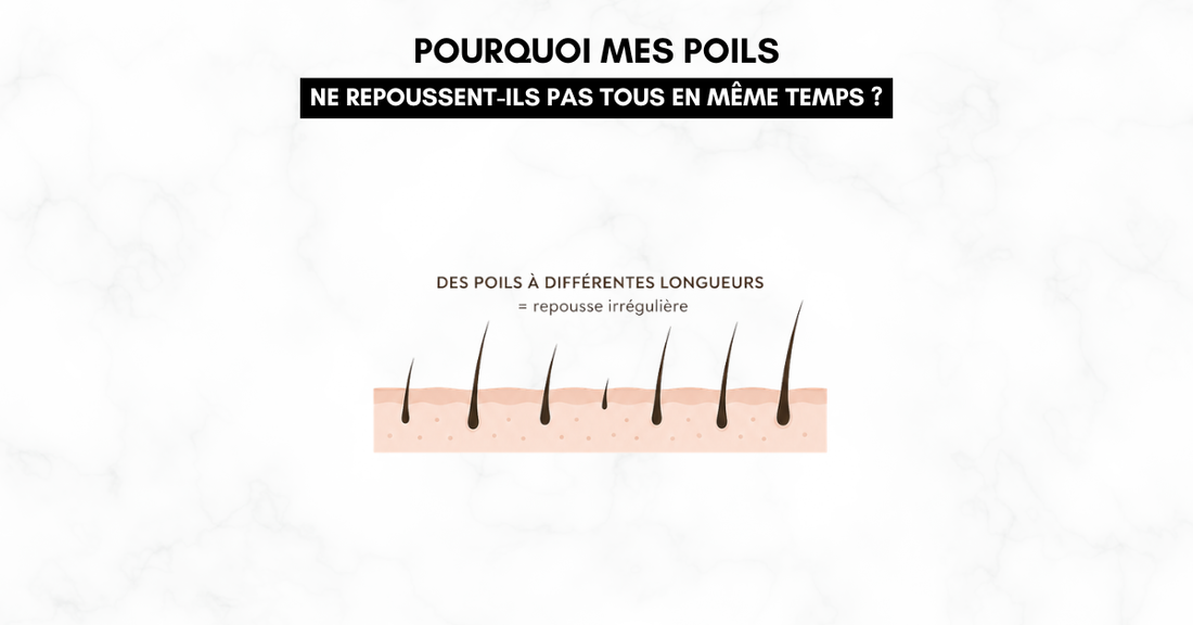 Pourquoi mes poils ne repoussent-ils pas tous en même temps ?